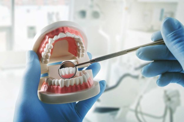 dental implants a dentist explains the dental implant procedure and dental implant options after a patient asks what are dental implants