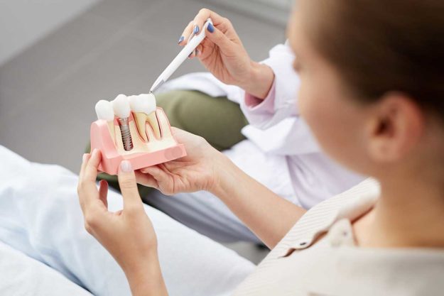Are-Dental-Implants-Safe- doctor explains dental implants