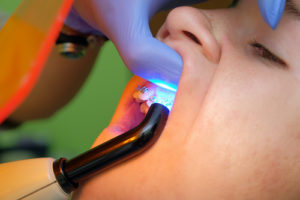 child at a dental office getting dental bonding