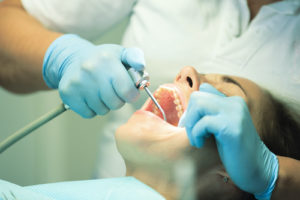 person getting tooth extraction services