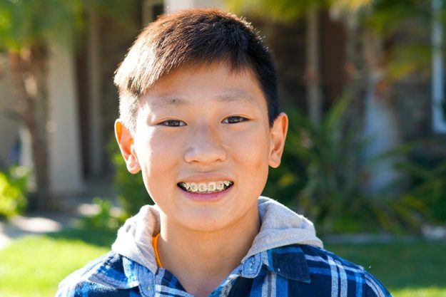 3-Benefits-of-Braces-for-Kids young boy receiving braces for kids